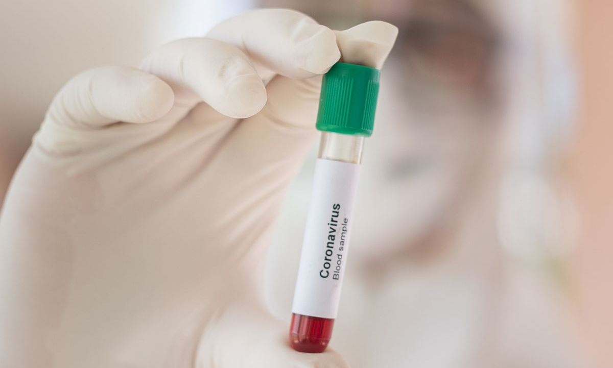 Pegawai CPI Sembuh dari Covid-19